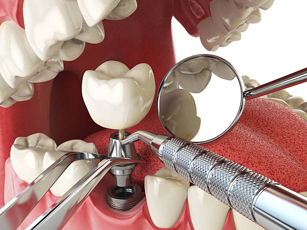 Best Emergency Treatment for Oral Infections in Bernice, LA